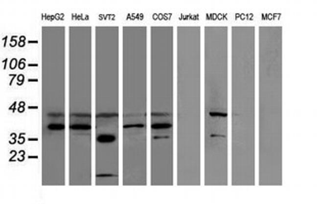 SULT1C2 Antibody in Western Blot (WB)