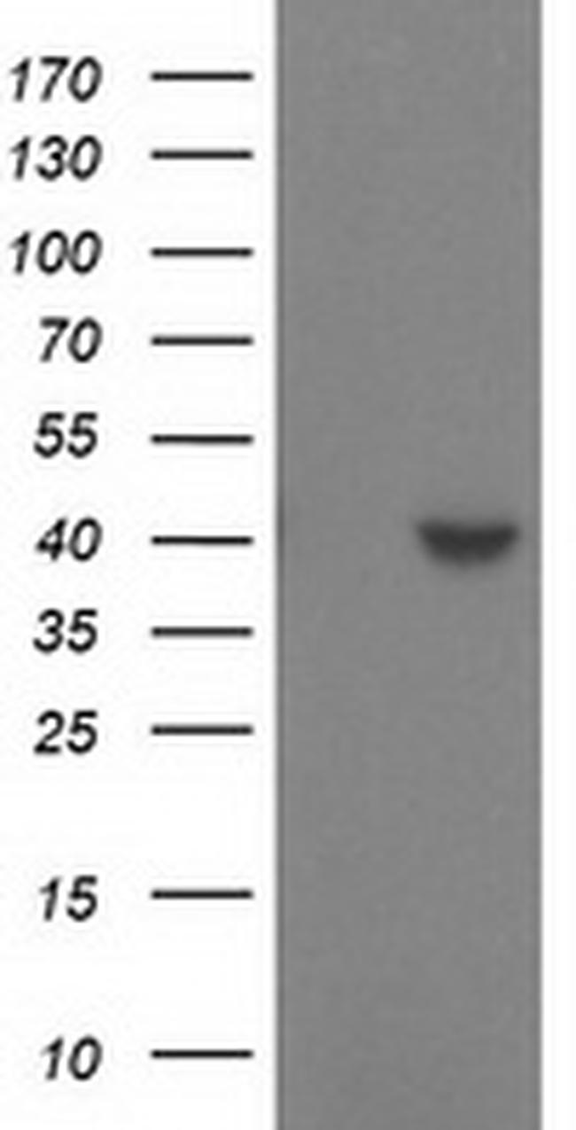 SULT1C2 Antibody in Western Blot (WB)