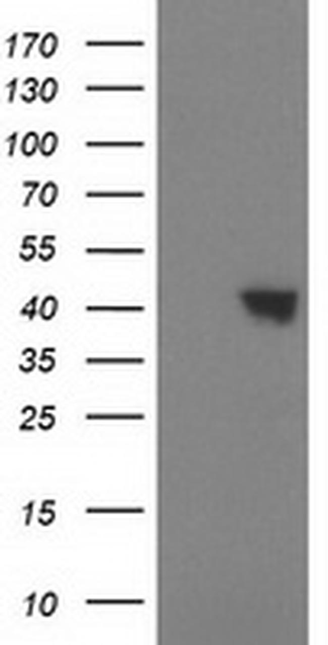 SULT1C2 Antibody in Western Blot (WB)