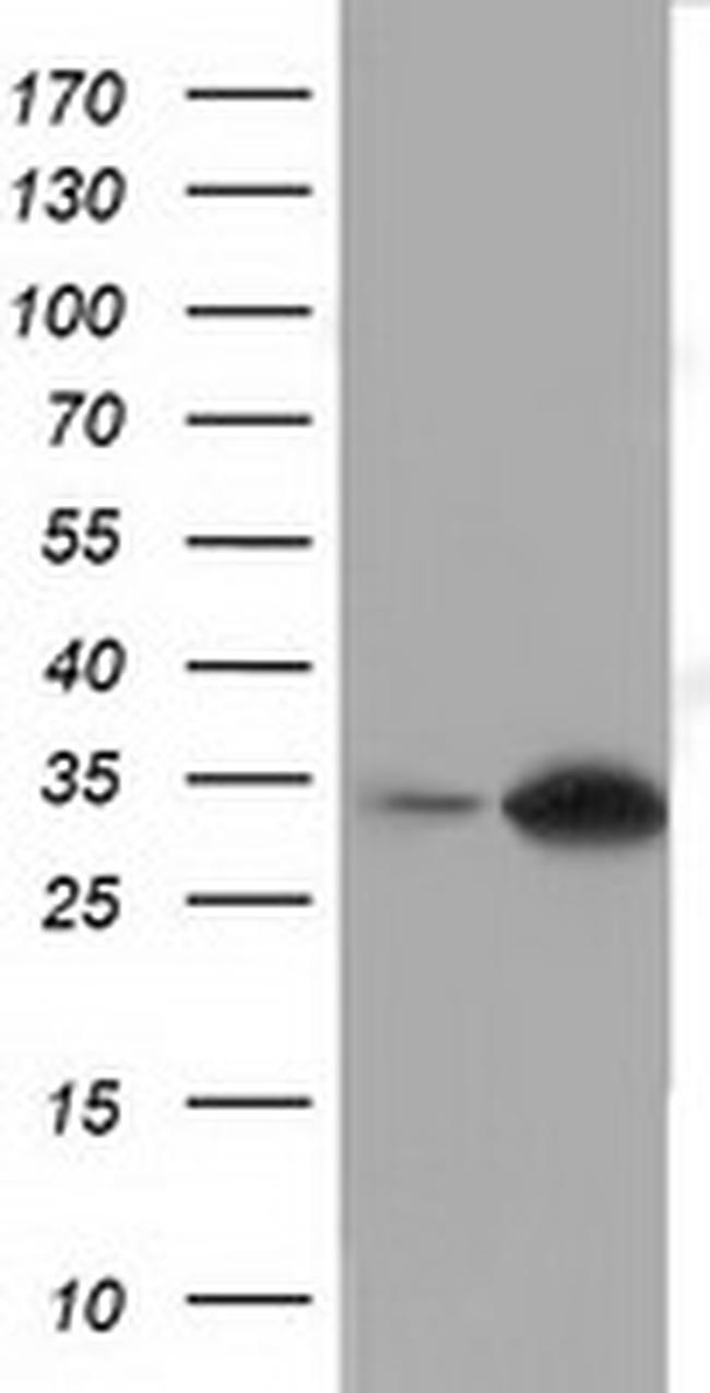 SULT2A1 Antibody in Western Blot (WB)