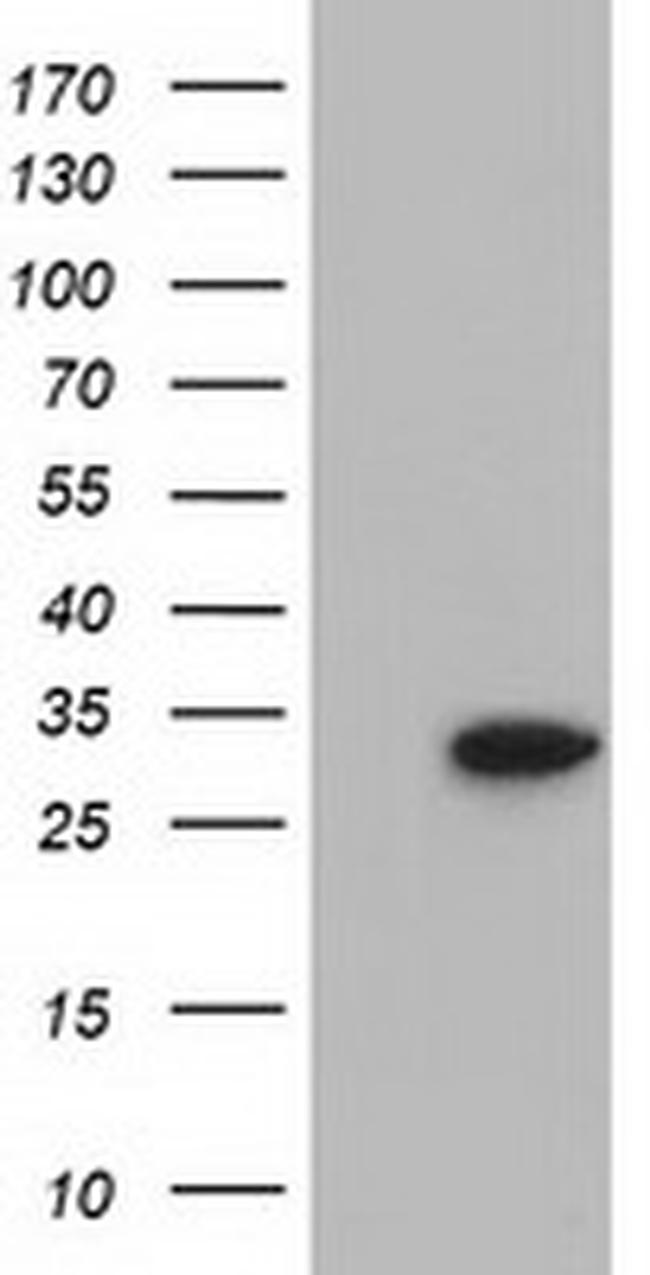 SULT2A1 Antibody in Western Blot (WB)