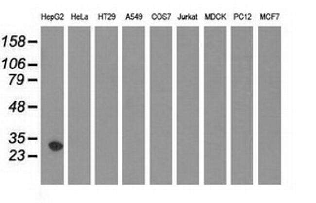 SULT2A1 Antibody in Western Blot (WB)