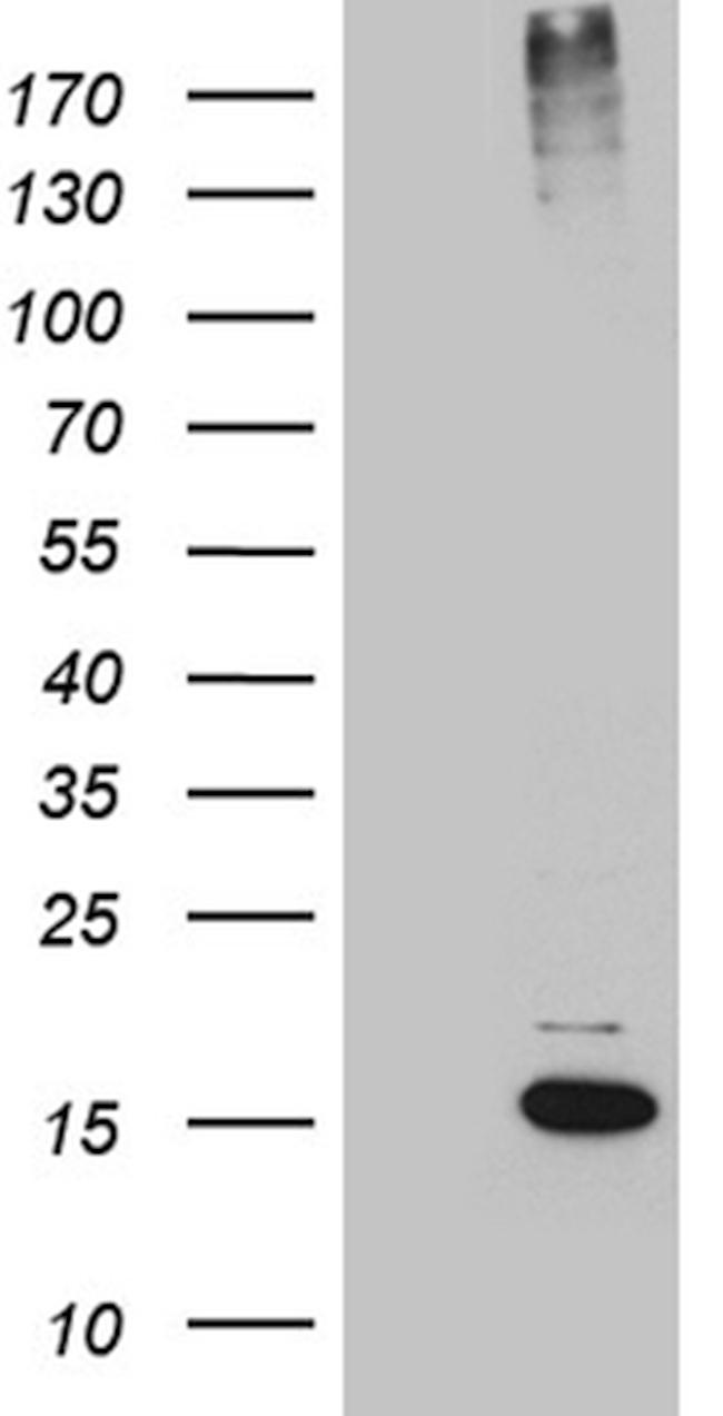 SUMO1 Antibody in Western Blot (WB)