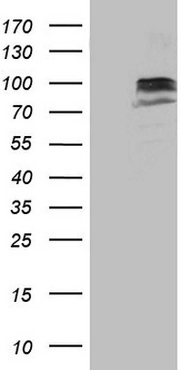 SUOX Antibody in Western Blot (WB)