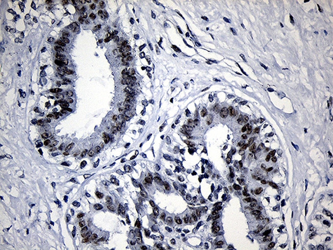 SUPT16H Antibody in Immunohistochemistry (Paraffin) (IHC (P))