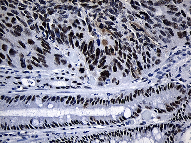 SUPT16H Antibody in Immunohistochemistry (Paraffin) (IHC (P))