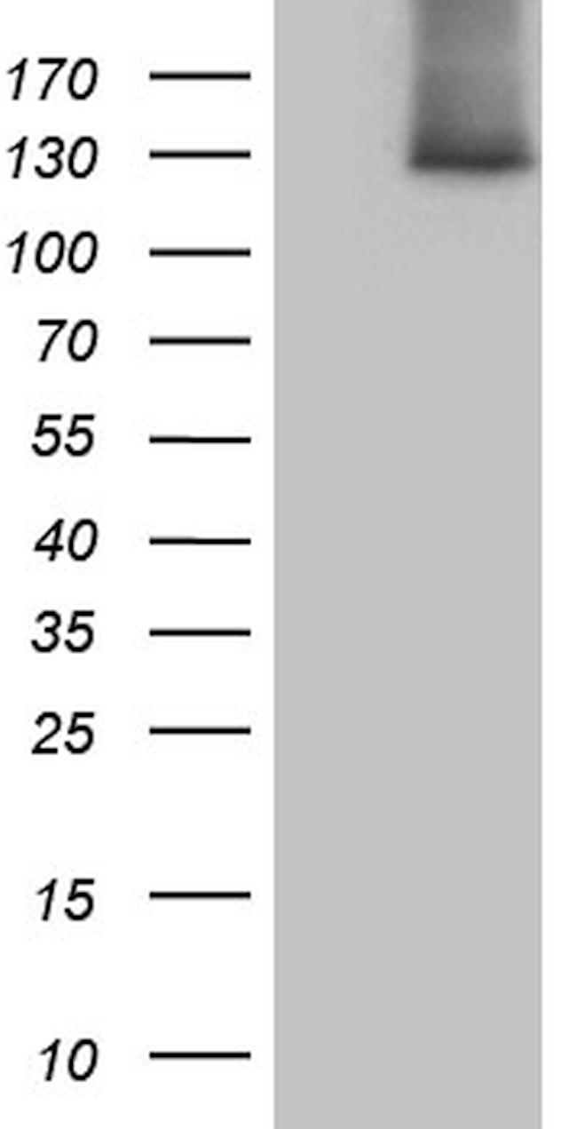 SUPT16H Antibody in Western Blot (WB)