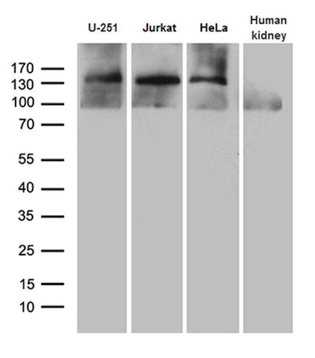 SUPT16H Antibody in Western Blot (WB)