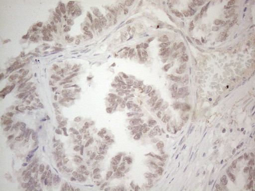 SUPT3H Antibody in Immunohistochemistry (Paraffin) (IHC (P))