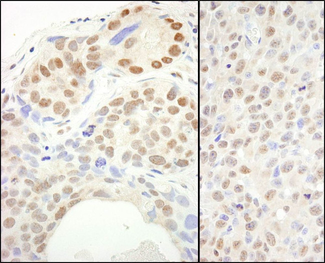 SUPT6H Antibody in Immunohistochemistry (IHC)