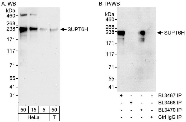 SUPT6H Antibody in Western Blot (WB)