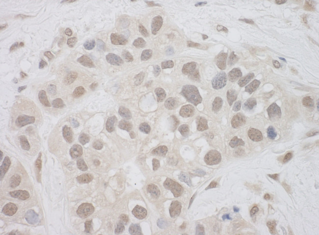 SUPT7L Antibody in Immunohistochemistry (IHC)