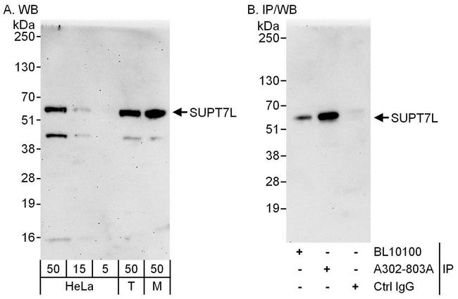 SUPT7L Antibody in Western Blot (WB)