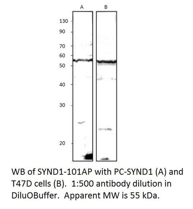 Syndecan-1 Antibody in Western Blot (WB)