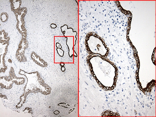 SYNE1 Antibody in Immunohistochemistry (Paraffin) (IHC (P))