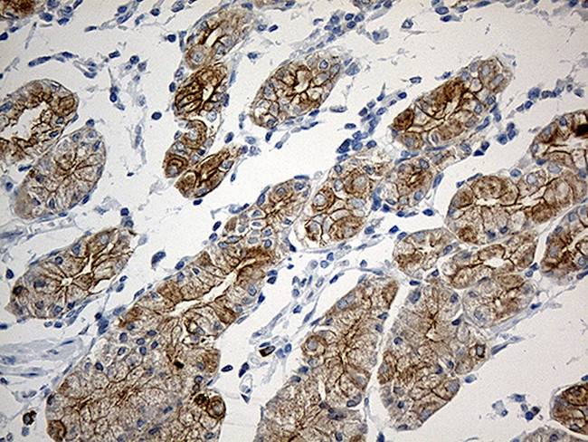 SYNE1 Antibody in Immunohistochemistry (Paraffin) (IHC (P))