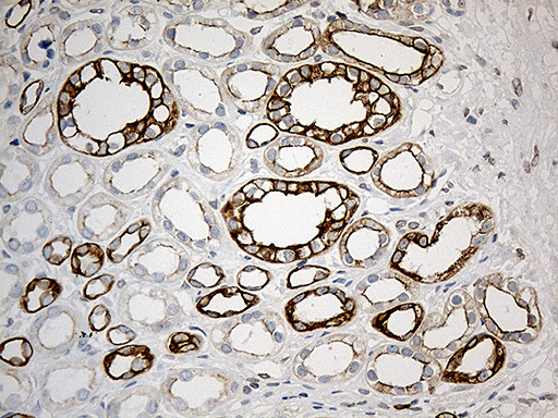 SYNE1 Antibody in Immunohistochemistry (Paraffin) (IHC (P))