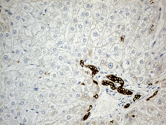 SYNE1 Antibody in Immunohistochemistry (Paraffin) (IHC (P))