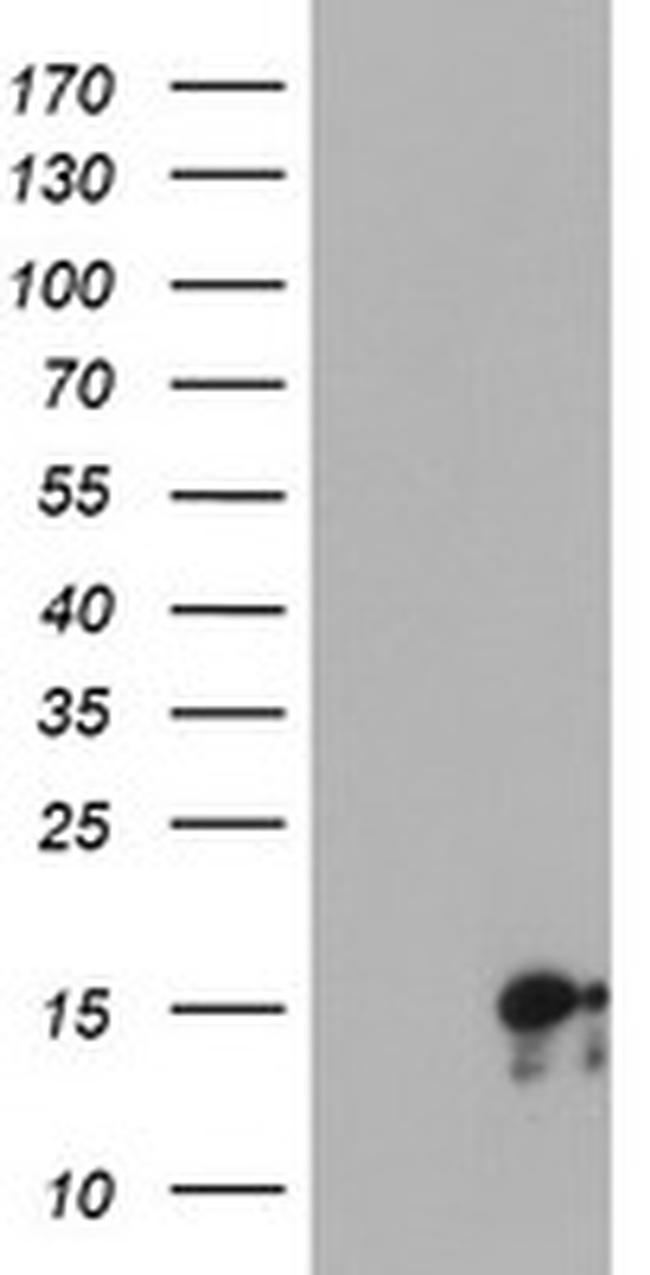SYNJ2BP Antibody in Western Blot (WB)