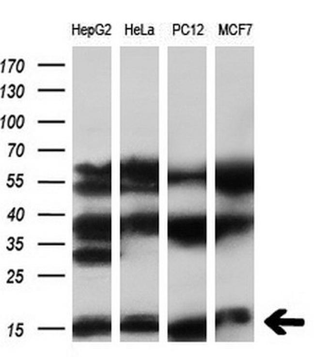 SYNJ2BP Antibody in Western Blot (WB)