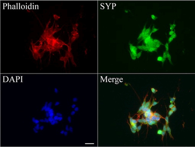 SYP Antibody in Immunocytochemistry (ICC/IF)