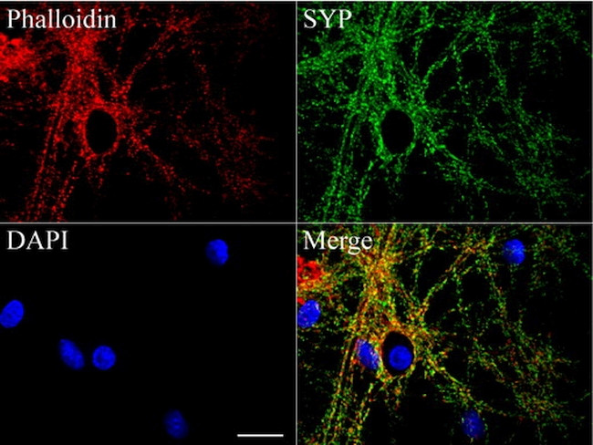 SYP Antibody in Immunocytochemistry (ICC/IF)