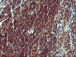 SYP Antibody in Immunohistochemistry (Paraffin) (IHC (P))