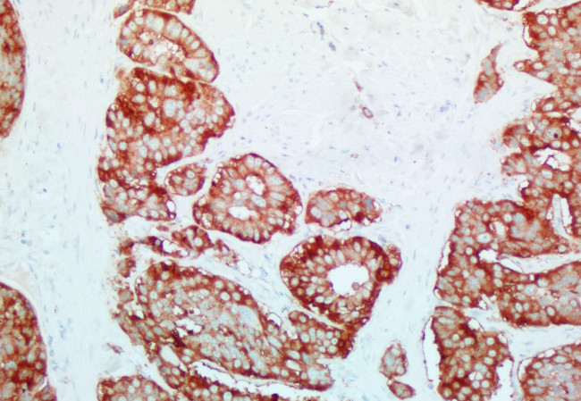 SYP Antibody in Immunohistochemistry (Paraffin) (IHC (P))