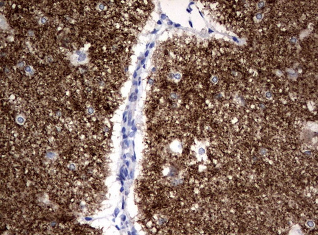 SYP Antibody in Immunohistochemistry (Paraffin) (IHC (P))