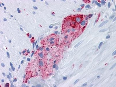 Synaptophysin Antibody in Immunohistochemistry (Paraffin) (IHC (P))