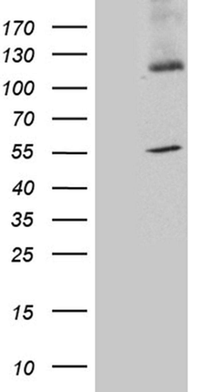 SYT11 Antibody in Western Blot (WB)