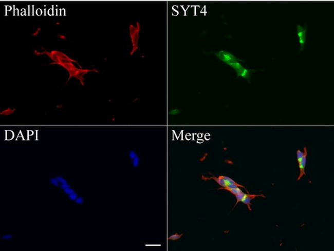 SYT4 Antibody in Immunocytochemistry (ICC/IF)