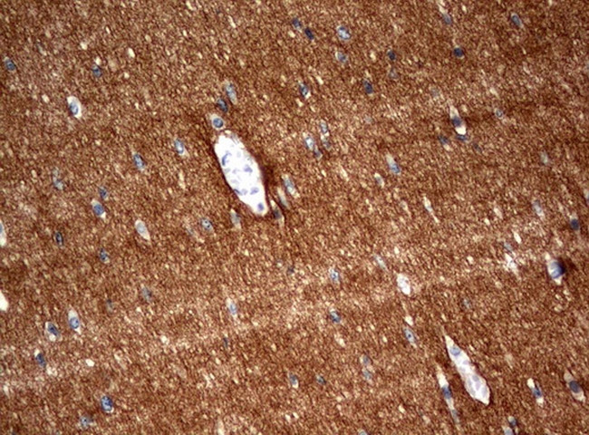 SYT4 Antibody in Immunohistochemistry (Paraffin) (IHC (P))