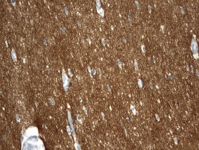 SYT4 Antibody in Immunohistochemistry (Paraffin) (IHC (P))