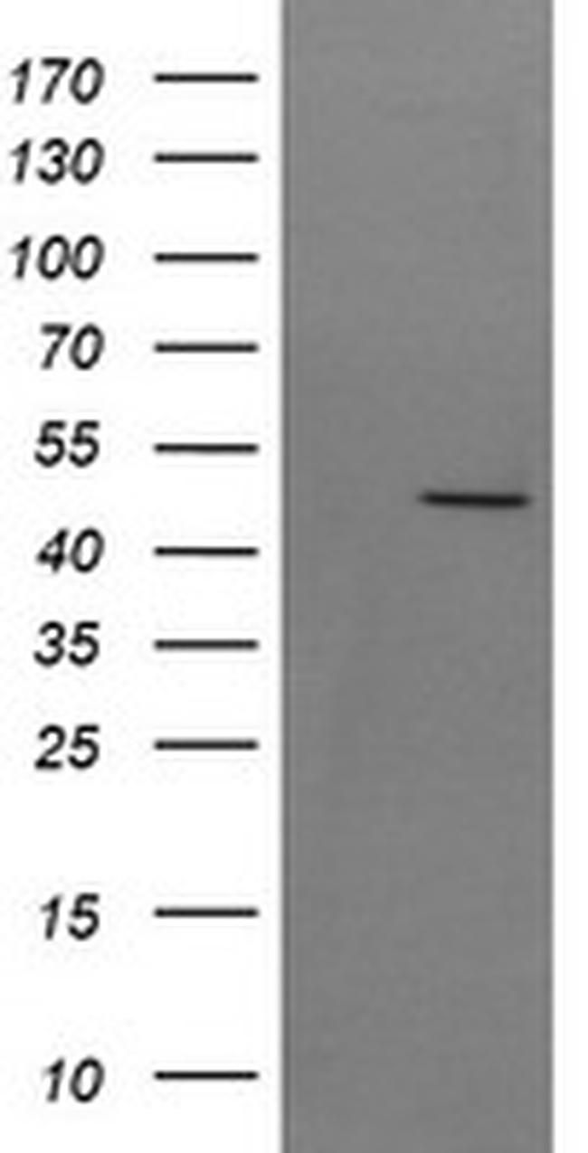 SYT4 Antibody in Western Blot (WB)