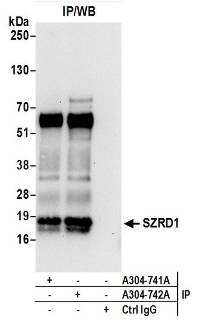 SZRD1 Antibody in Western Blot (WB)