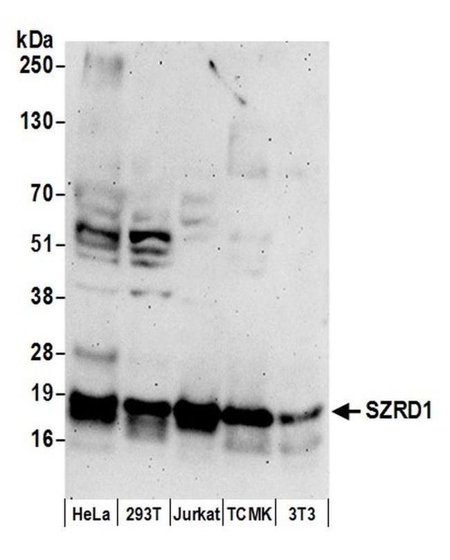 SZRD1 Antibody in Western Blot (WB)