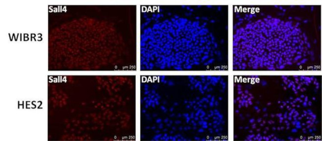 SALL4 Antibody in Immunocytochemistry (ICC/IF)