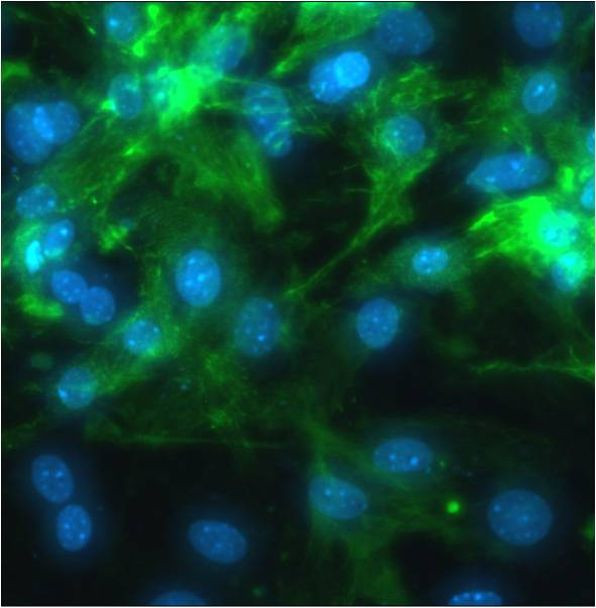 Sarcomeric alpha Actin Antibody in Immunocytochemistry (ICC/IF)