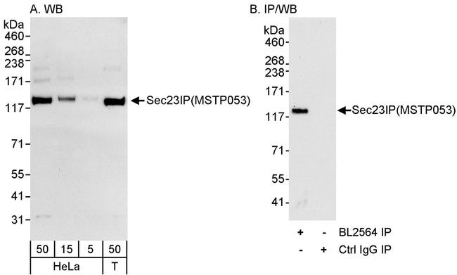 Sec23IP/MSTP053 Antibody in Western Blot (WB)