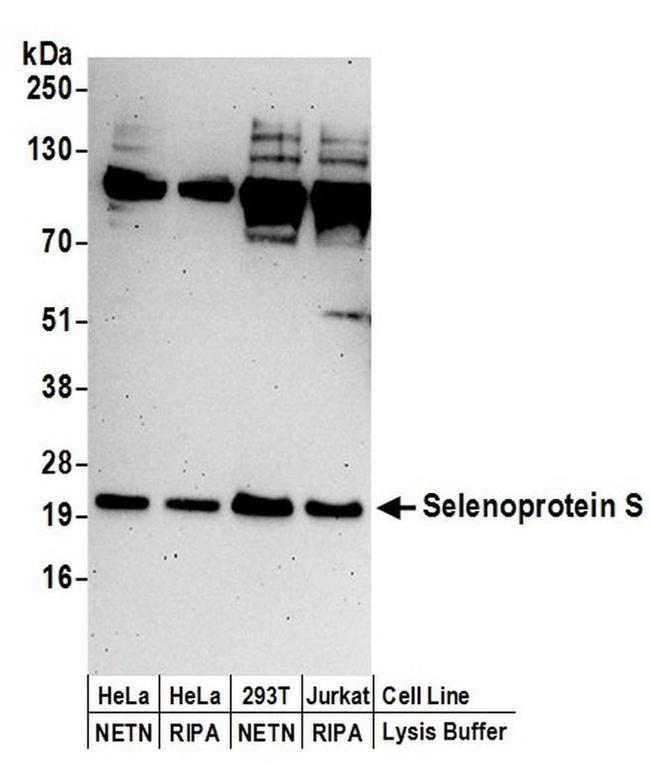 Selenoprotein S Antibody in Western Blot (WB)