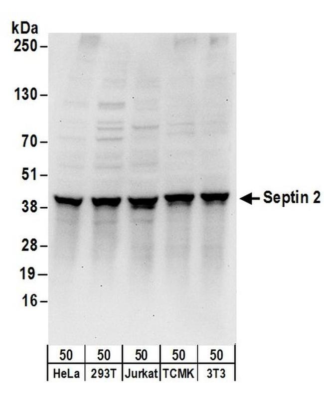 Septin 2 Antibody in Western Blot (WB)