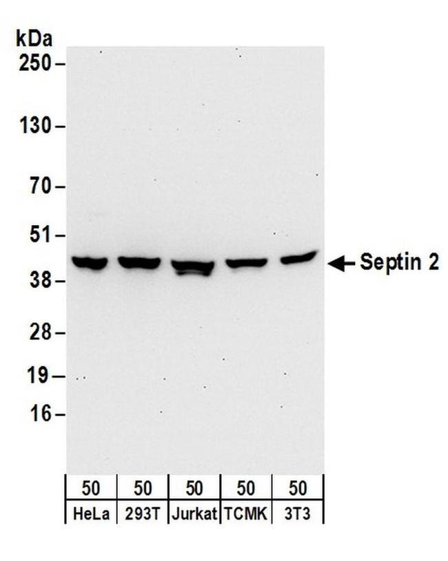 Septin 2 Antibody in Western Blot (WB)