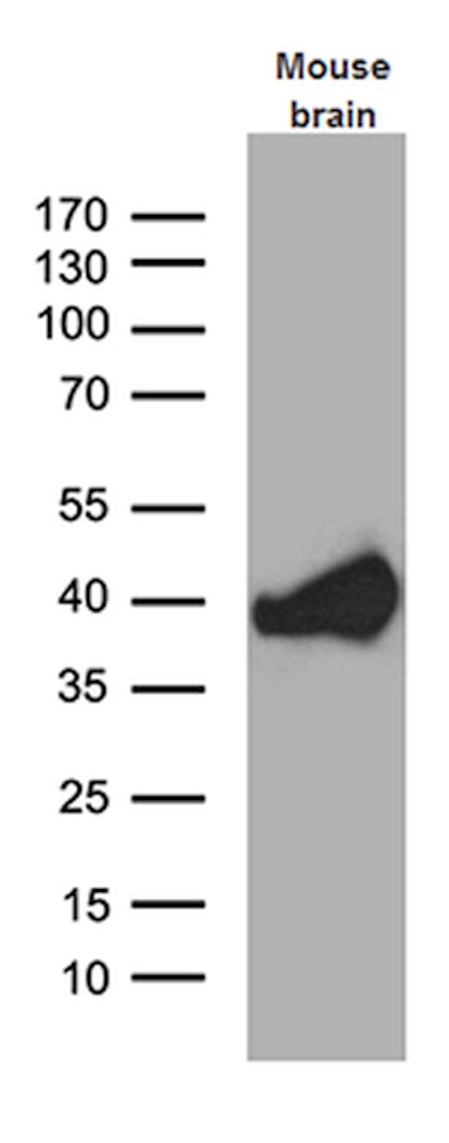 Septin 3 Antibody in Western Blot (WB)