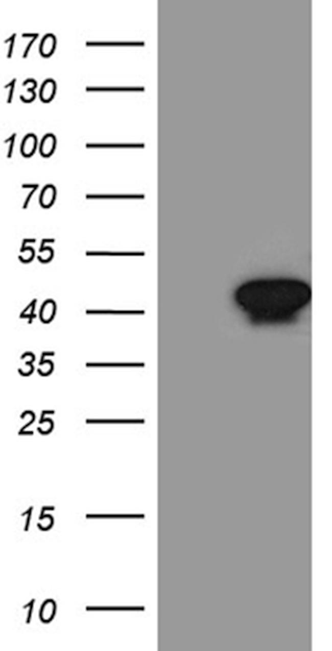 Septin 3 Antibody in Western Blot (WB)