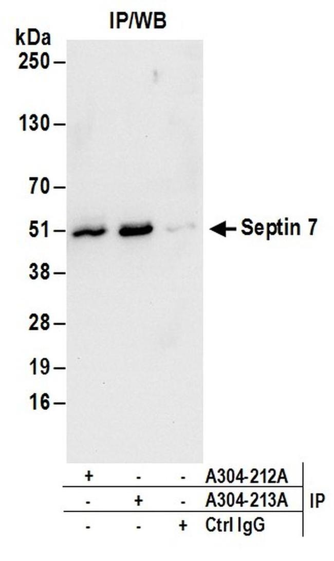 Septin 7 Antibody in Western Blot (WB)