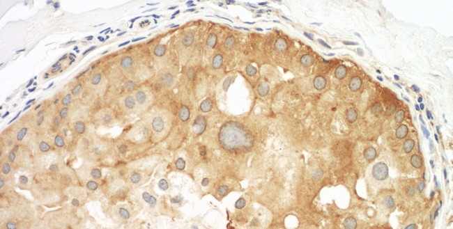 Septin 9 Antibody in Immunohistochemistry (IHC)