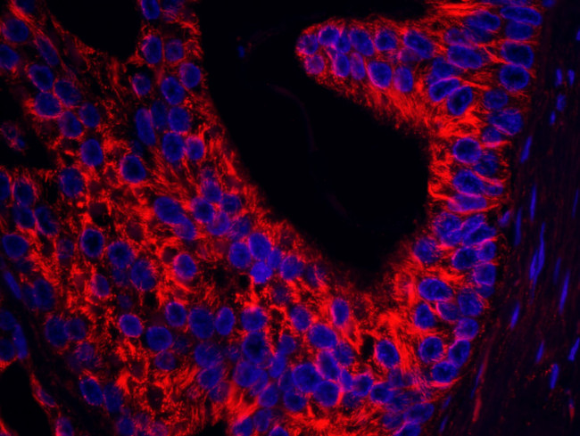 Septin 9 Antibody in Immunohistochemistry (IHC)