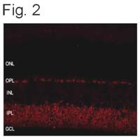 SHANK1 Antibody in Immunohistochemistry (IHC)