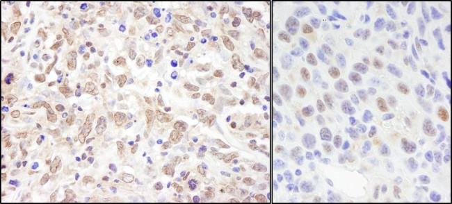 Sin3A Antibody in Immunohistochemistry (IHC)